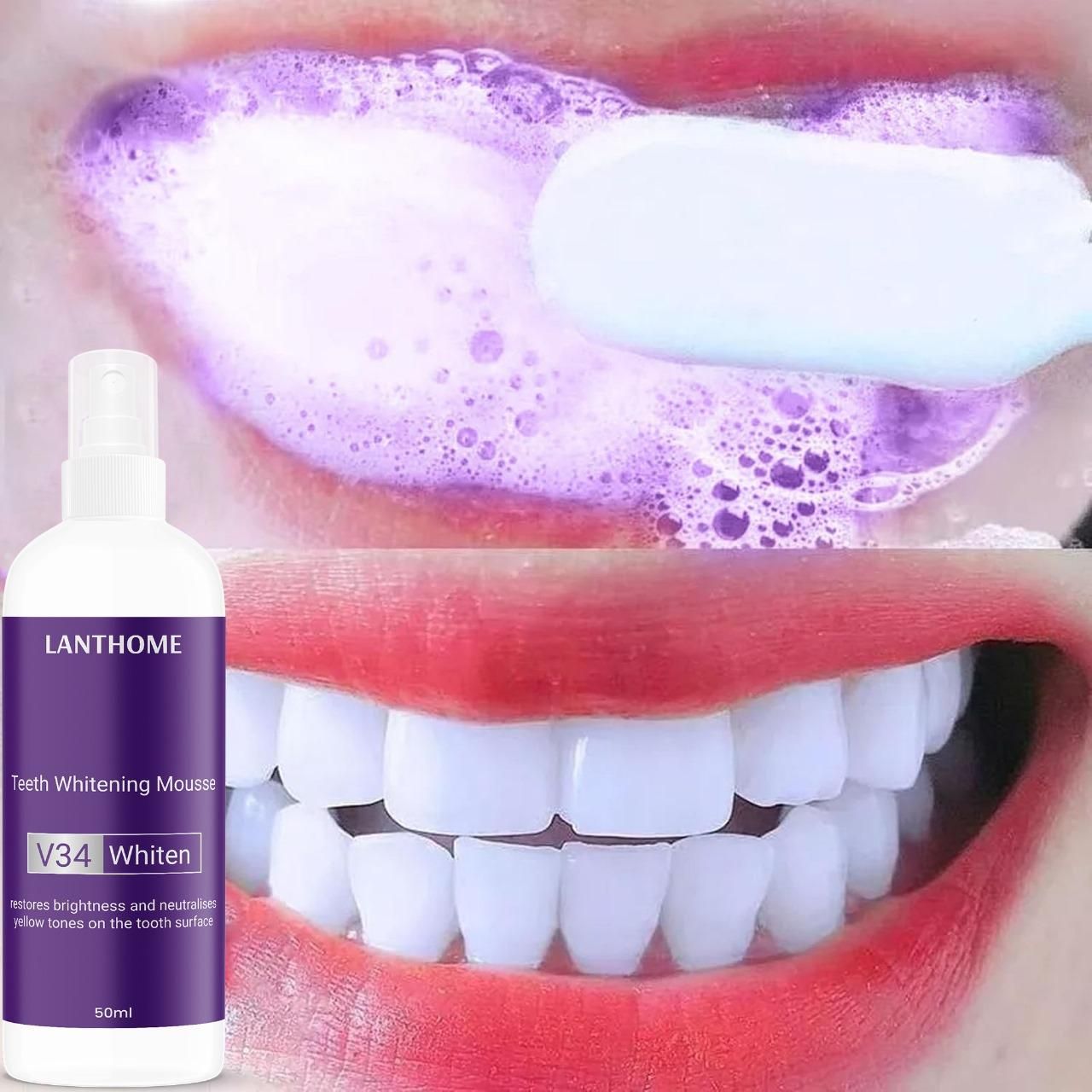 Lanthome Teeth Whitening Mousse V34 Spray 🦷