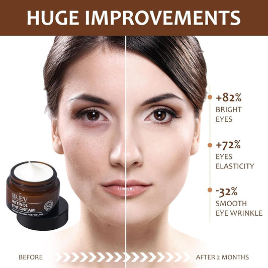 IREV Retinol Eye Cream 30 ml ✨