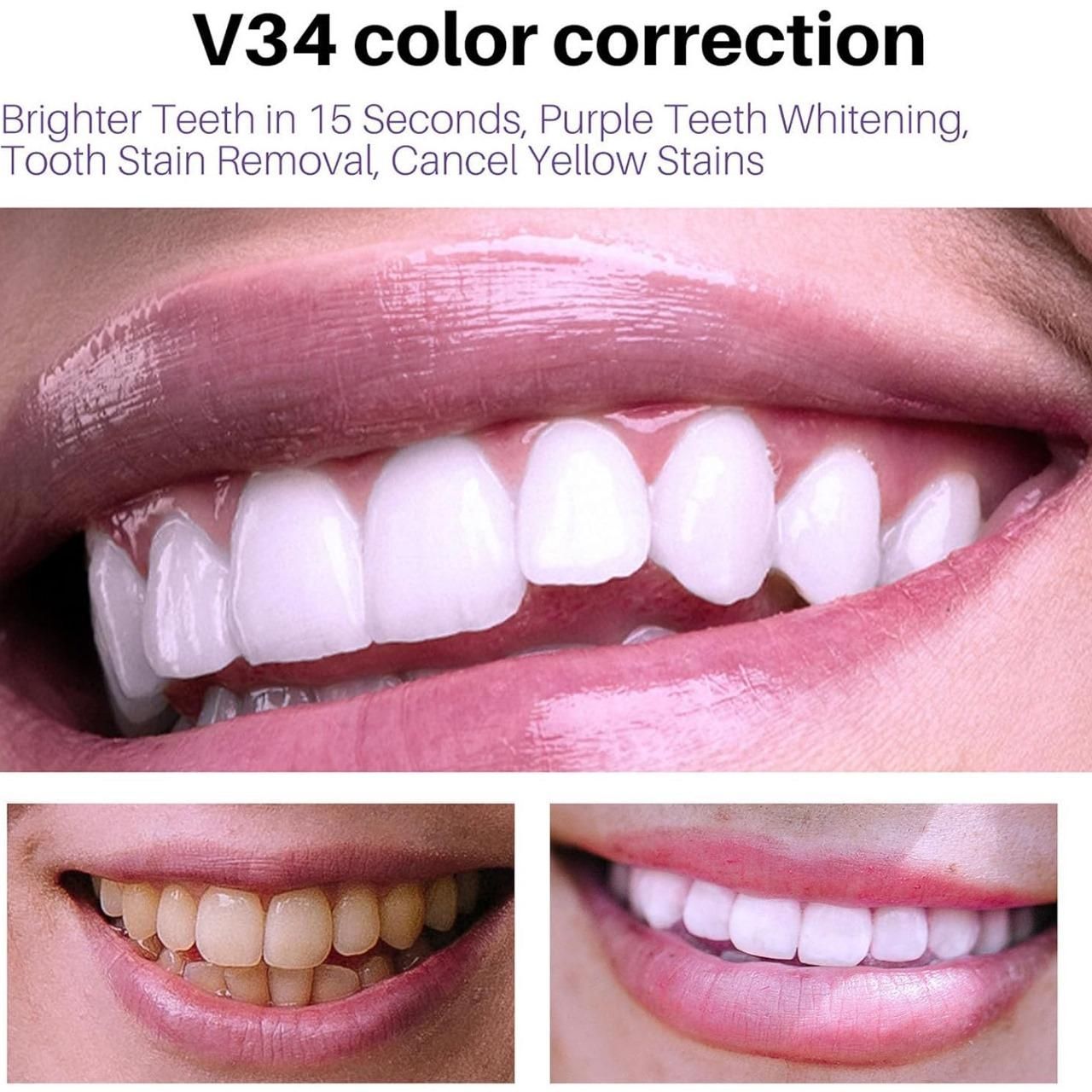 Lanthome Teeth Whitening Mousse V34 Spray 🦷